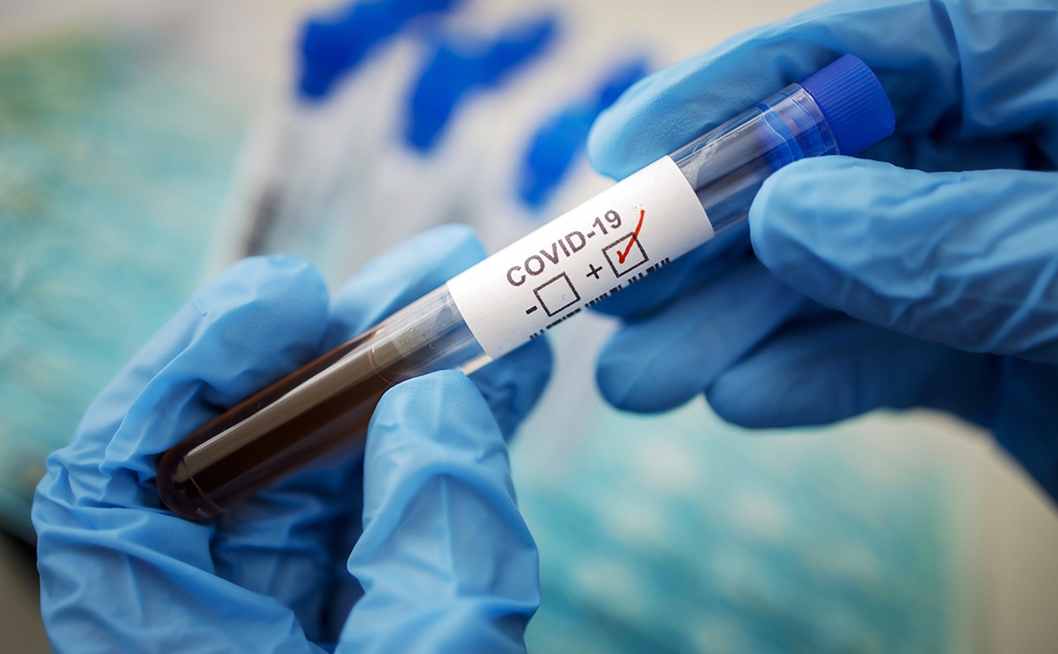 Коронавирус в Ленобласти: за последние сутки выявлено 82 новых случая